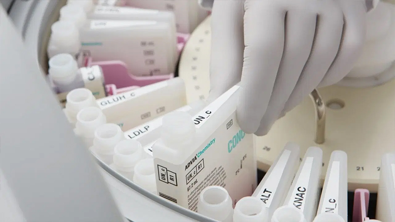 Siemens Advia Chemistry XPT System